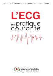 L’ECG en pratique courante