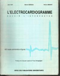 L'éléctrocardiogramme savoir l'interpreter