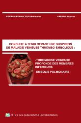 Conduite à tenir devant une suspicion de maladie veineuse –thromboembolique-