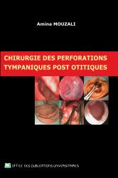 Chirurgie des perforations tympaniques post otitiques