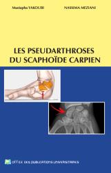 Les pseudarthroses du scaphoïde carpien