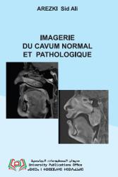 IMAGERIE DU CAVUM NORMAL ET PATHOLOGIQUE