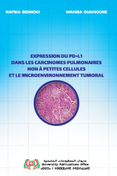 Expression du PD-L1 dans les carcinomes pulmonaires non à petites cellules et le microenvironnement tumoral