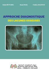 APPROCHE DIAGNOSTIQUE DES LACUNES OSSEUSES