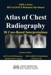 Atlas of Chest Radiography  50 Case-Based Interpretations