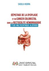 Dépistage de la dysplasie  et du Cancer Colorectal  dans la Rectocolite Hémorragique :  étude multicentrique Algéroise