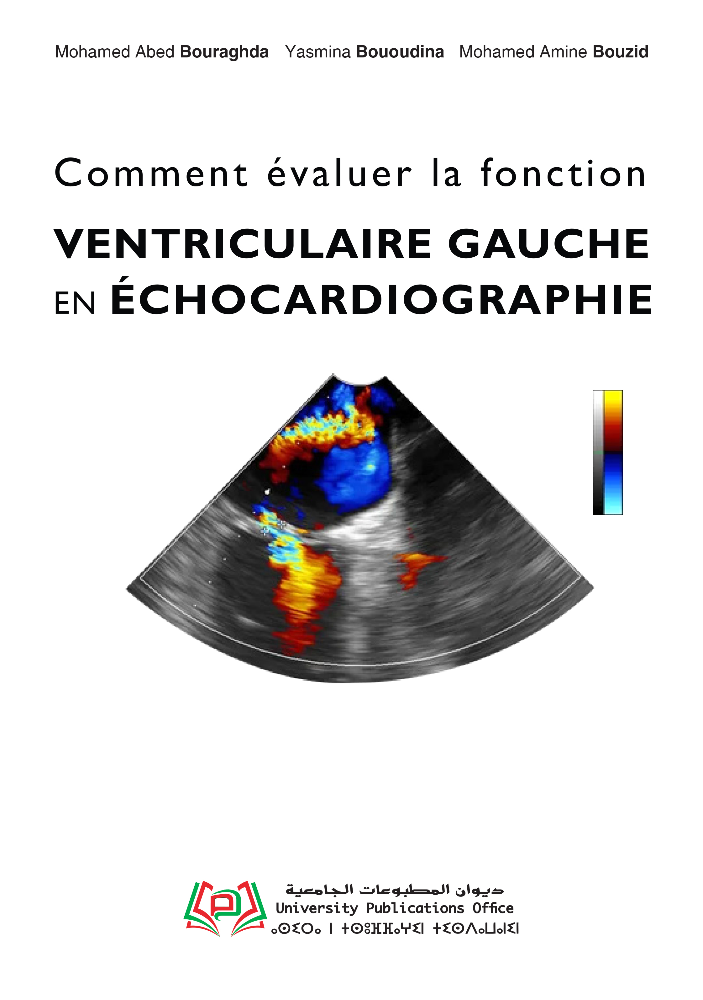 Comment évaluer la fonction ventriculaire gauche en échocardiographie