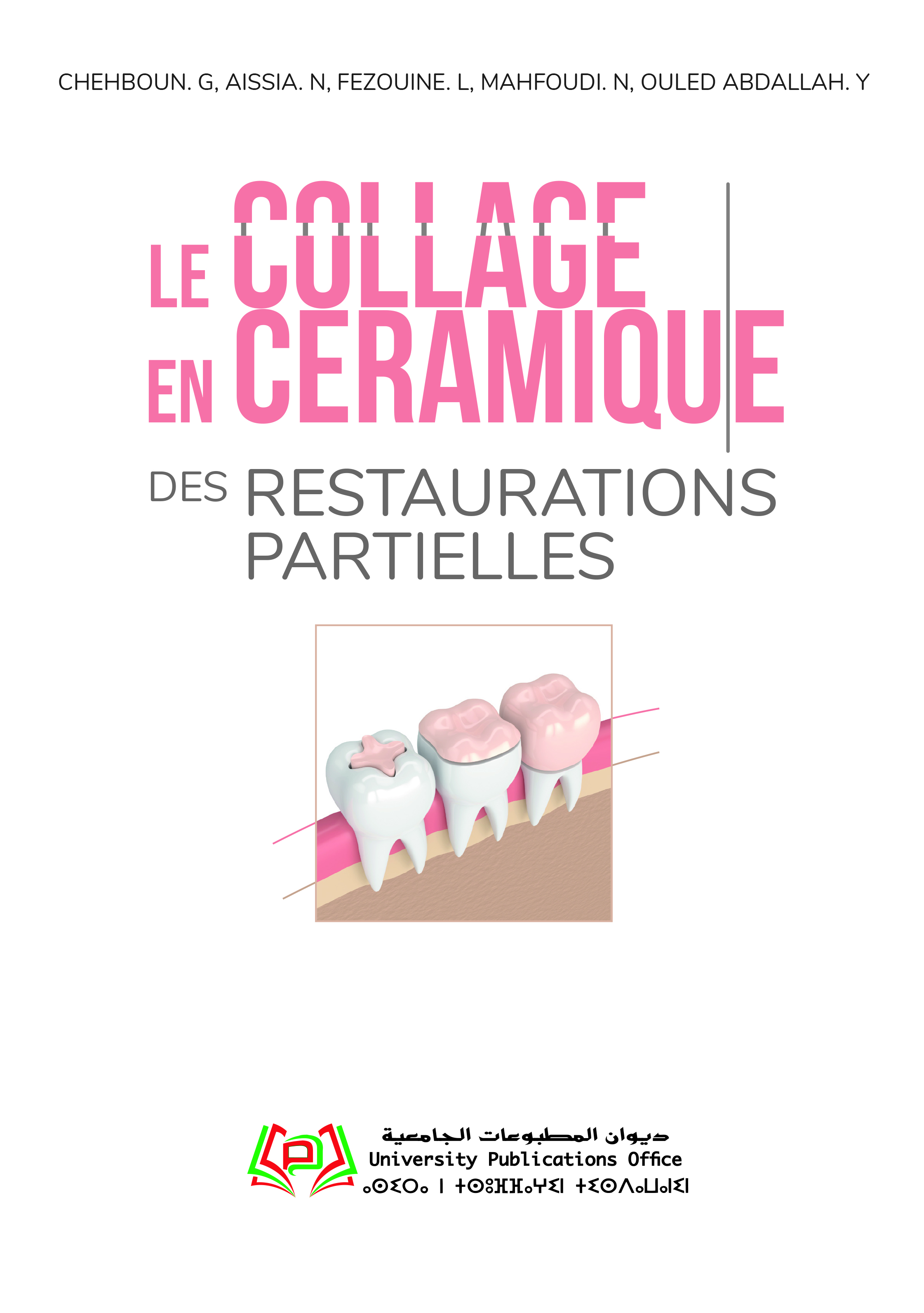 LE COLLAGE DES RESTAURATIONS PARTIELLES EN CERAMIQUE