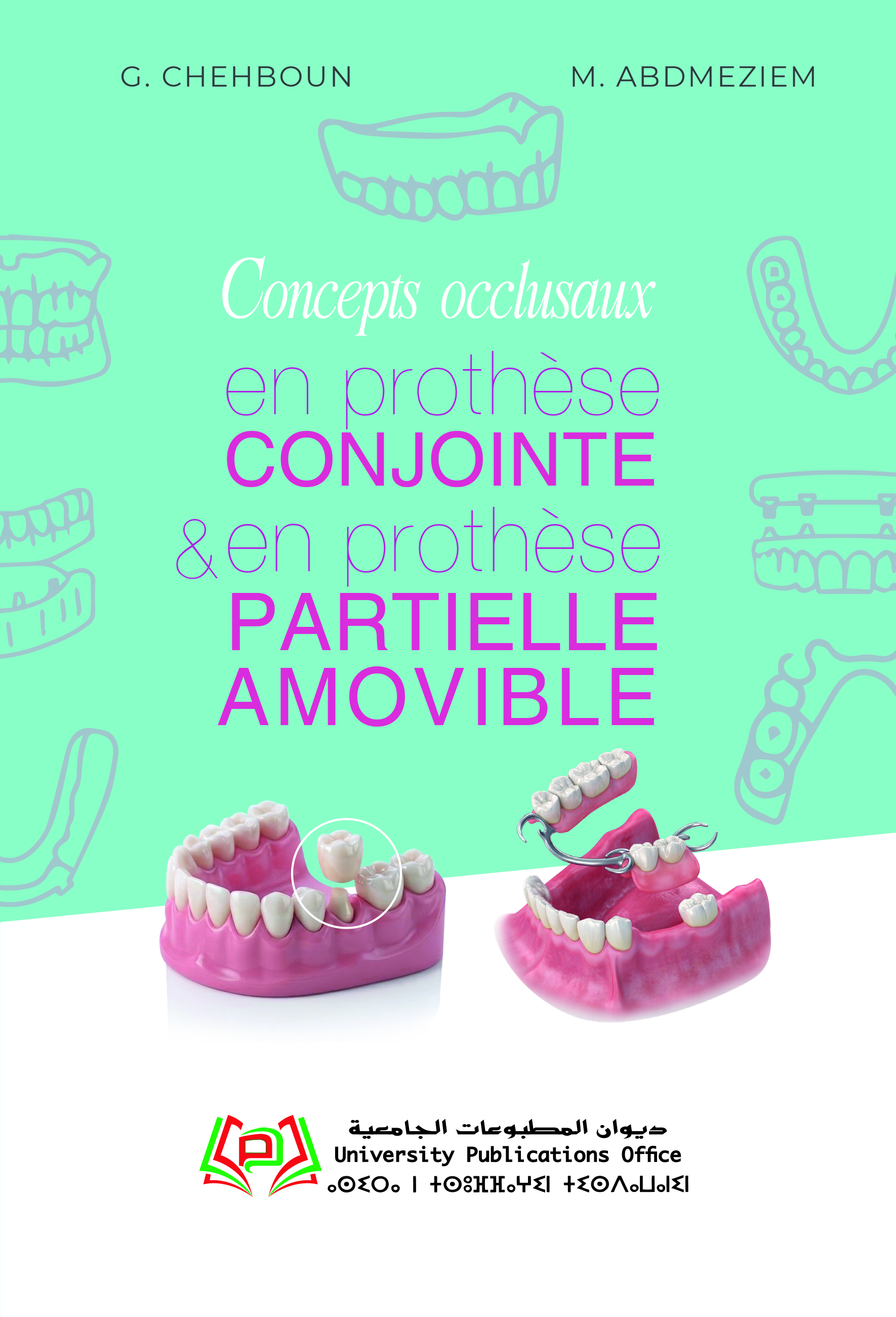 Concepts occlusaux en prothèse conjointe  et en prothèse partielle amovible