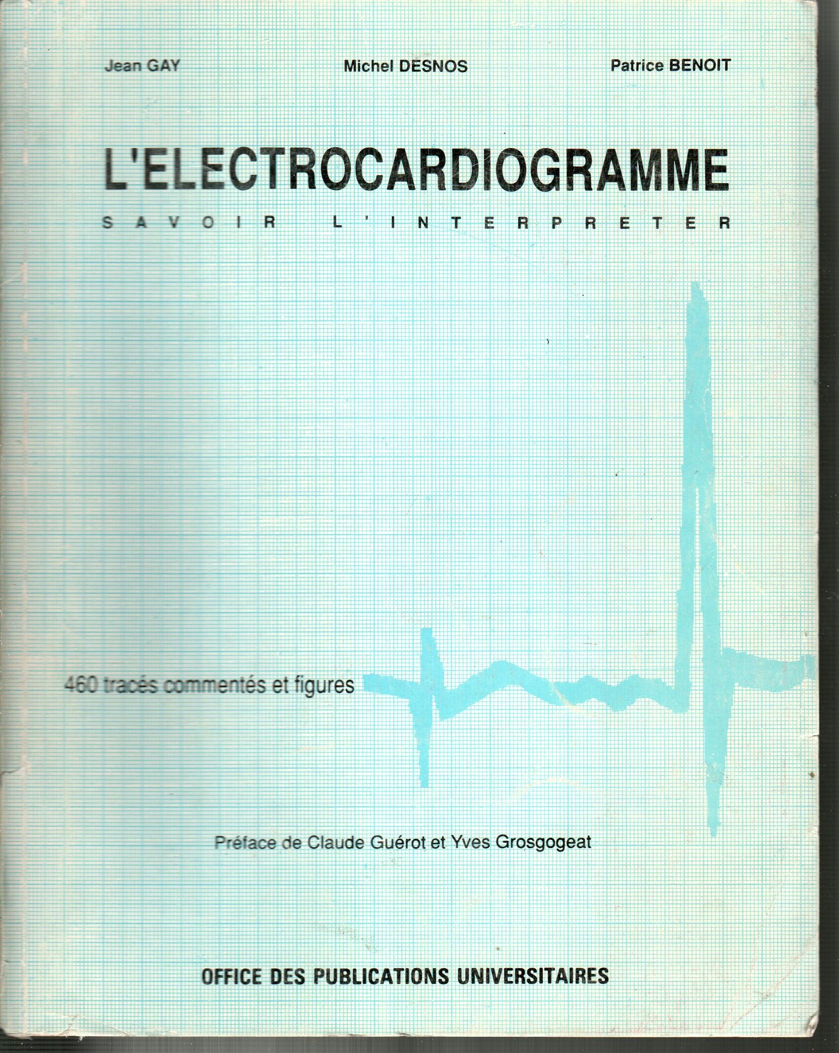 L'éléctrocardiogramme savoir l'interpreter