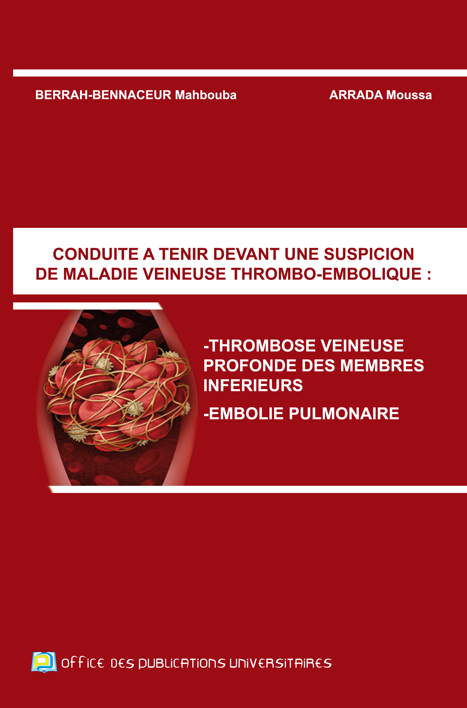 Conduite à tenir devant une suspicion de maladie veineuse –thromboembolique-