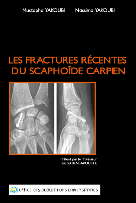 Les fractures récentes du Scaphoïde Carpien