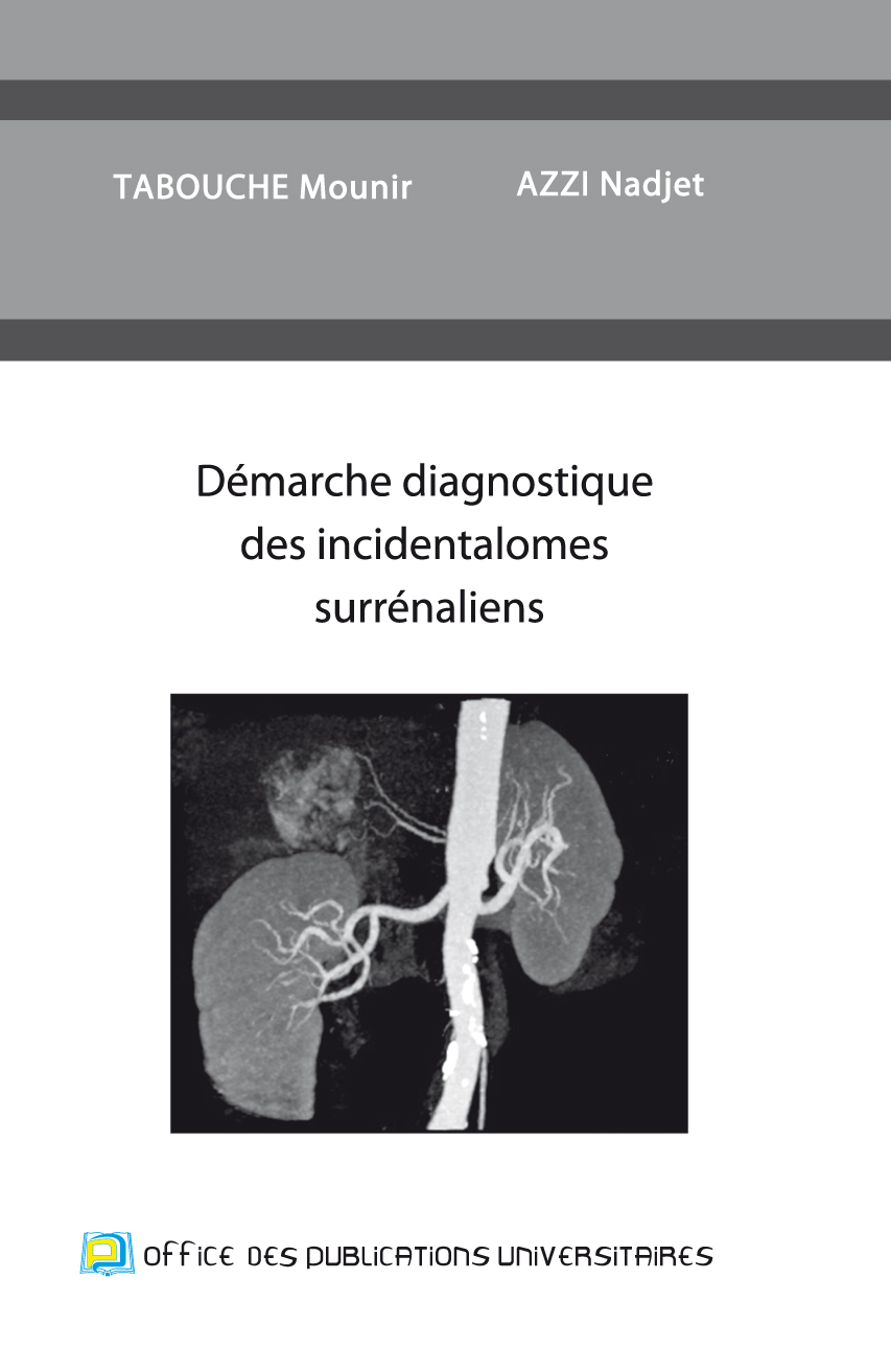 Démarche diagnostique des incidentalomes surrénaliens