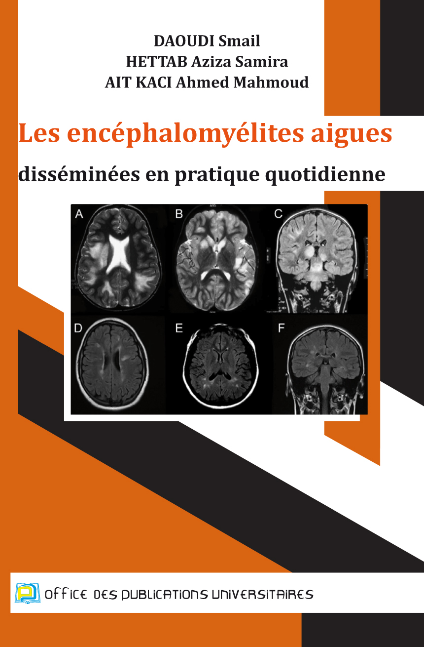 Les encéphalomyélites aigues disséminées en pratique quotidienne