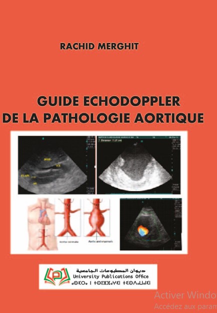 Guide écho DOPPLER de la pathologie aortique