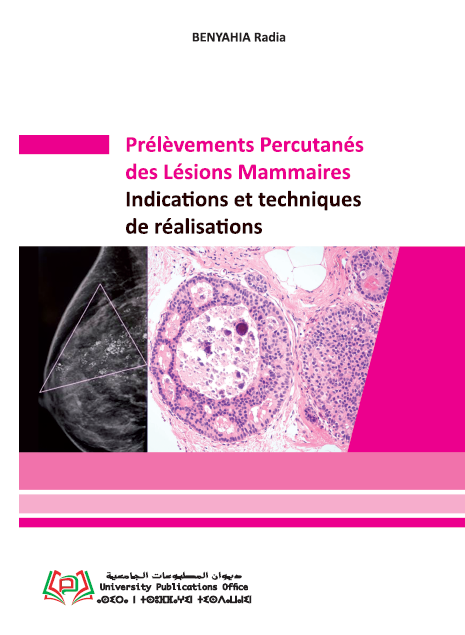 Prélèvements Percutanés des Lésions Mammaires Indications et techniques de réalisations