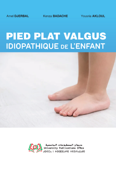 Pied plat valgus idiopathique de l’enfant