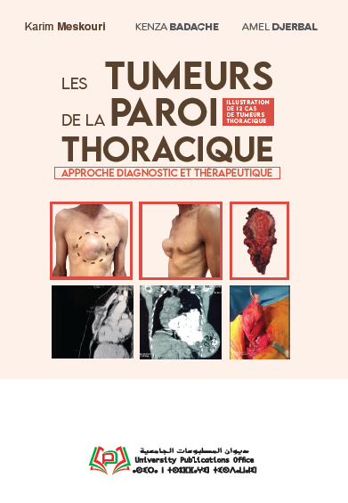 Les tumeurs de la paroi thoracique approche diagnostic et thérapeutique /illustration de 12 cas de tumeurs thoracique