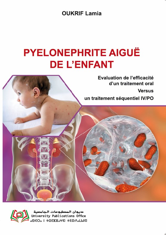 PYELONEPHRITE AIGUË  DE L’ENFANT