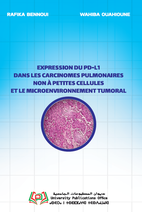 Expression du PD-L1 dans les carcinomes pulmonaires non à petites cellules et le microenvironnement tumoral