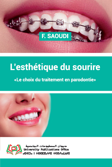 L’esthétique du sourire «Le choix du traitement en parodontie»
