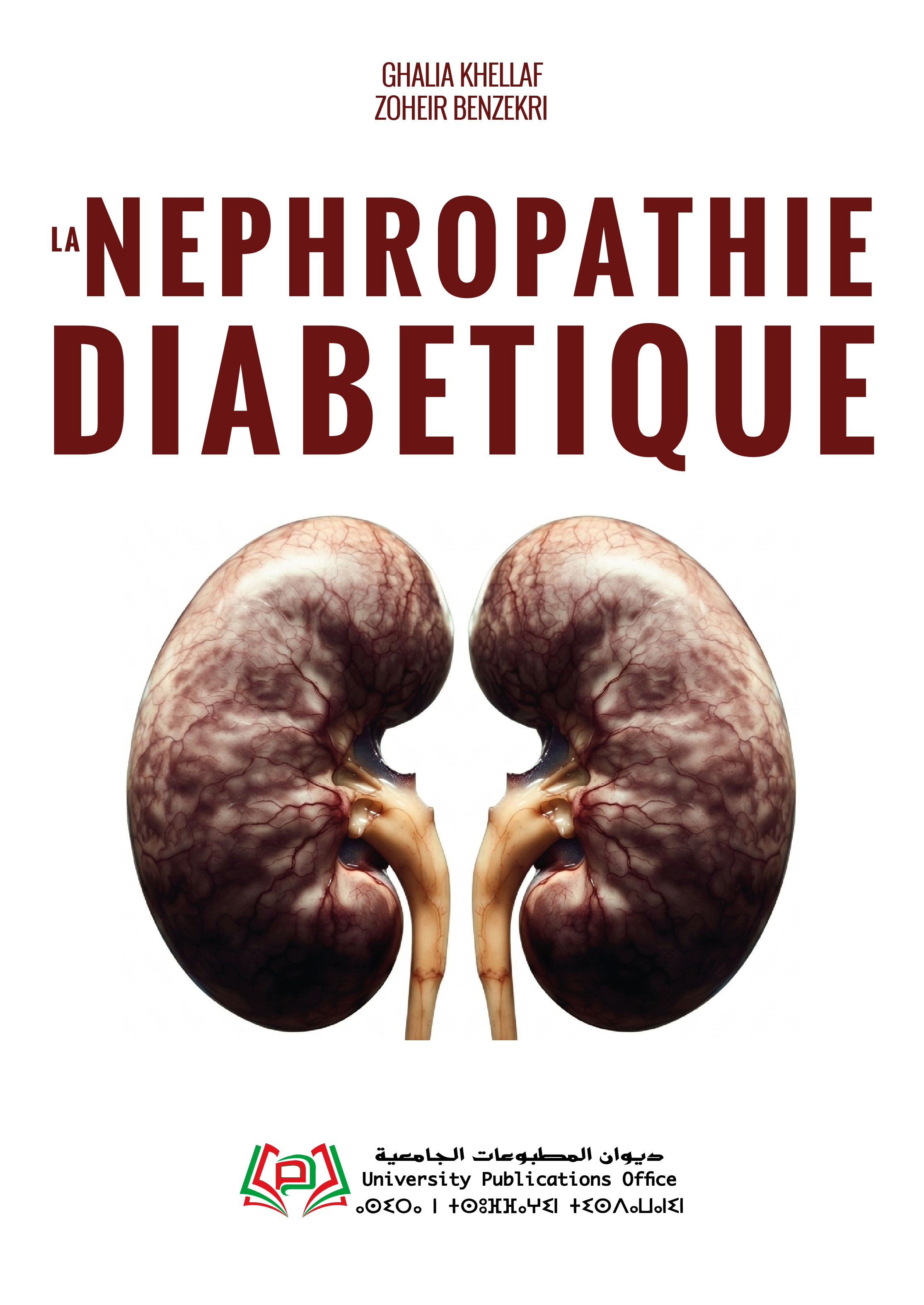 LA NEPHROPATHIE DIABETIQUE
