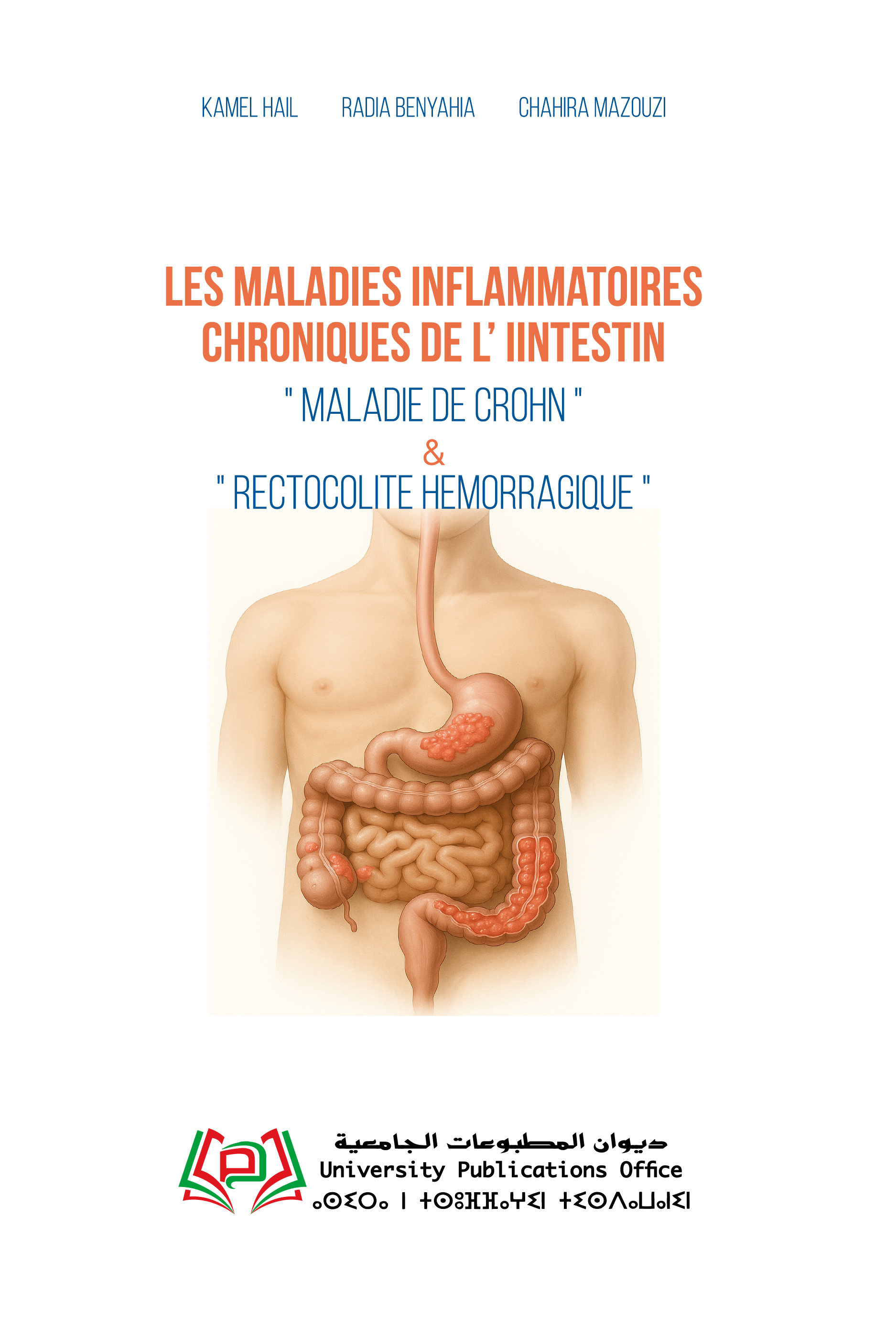 Les Maladies Inflammatoires Chroniques de l’Iintestin « Maladie de Crohn » & « Rectocolite hemorragique »