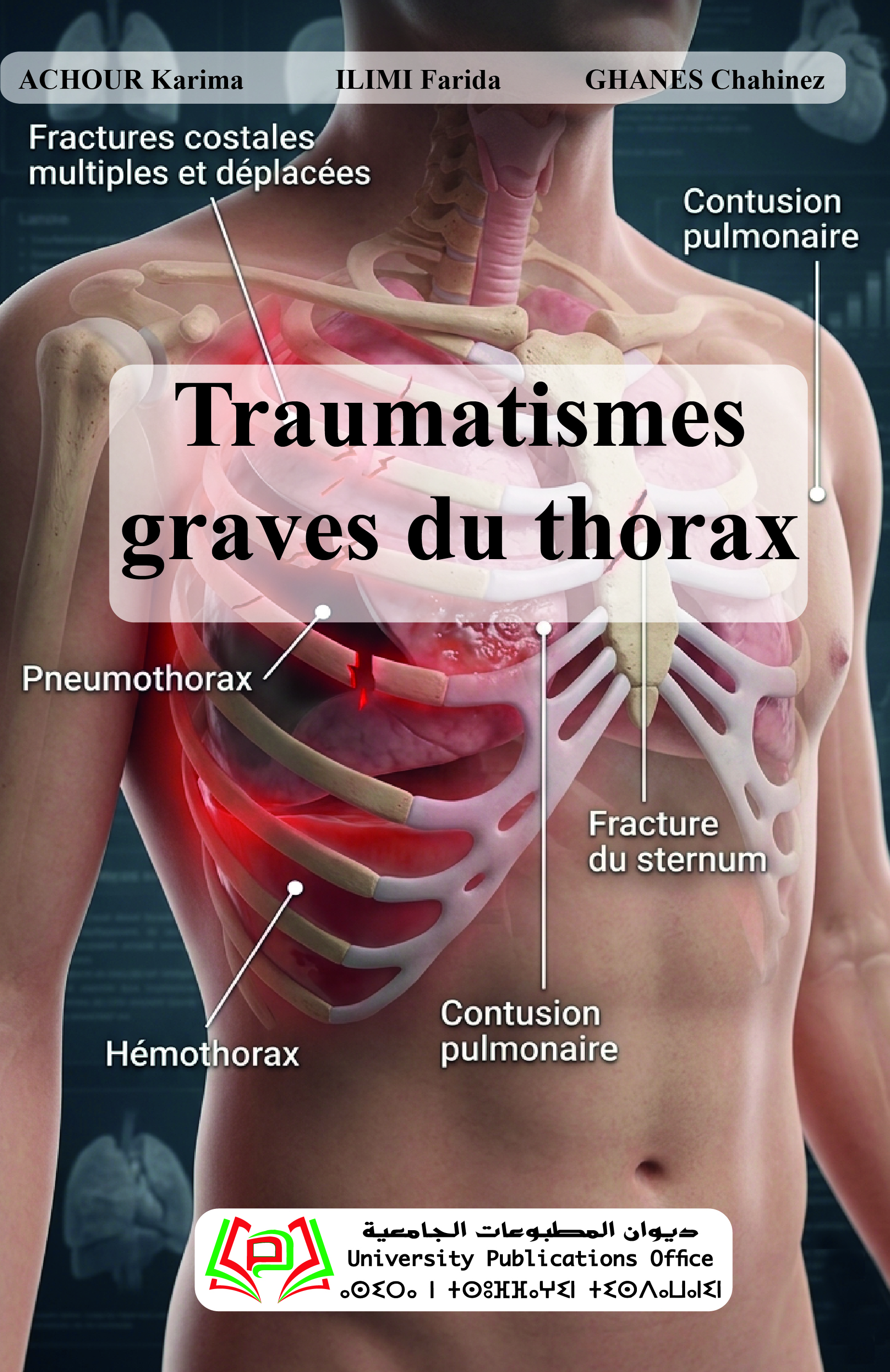 Traumatismes graves du thorax