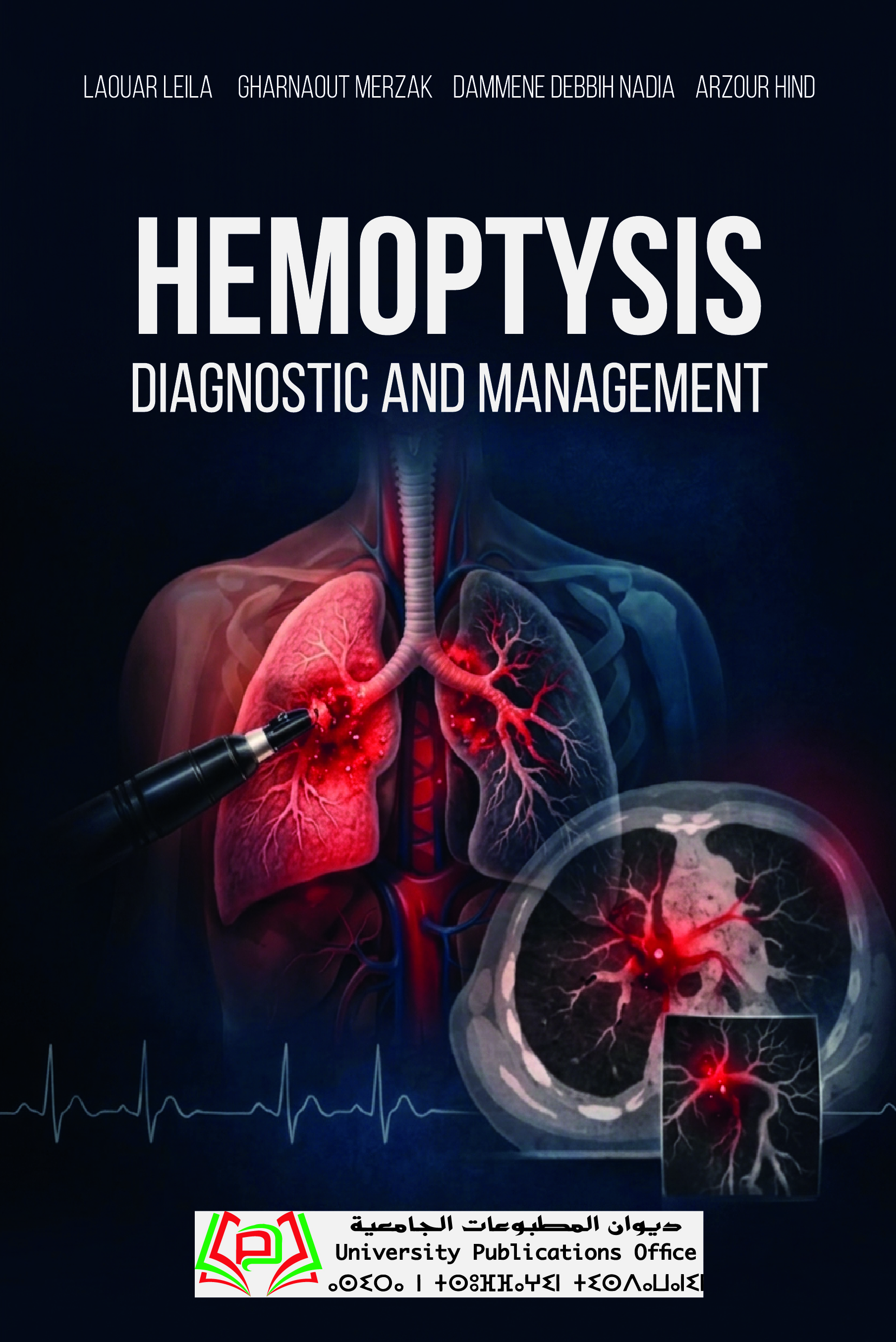 HEMOPTYSIS DIAGNOSTIC AND MANAGEMENT