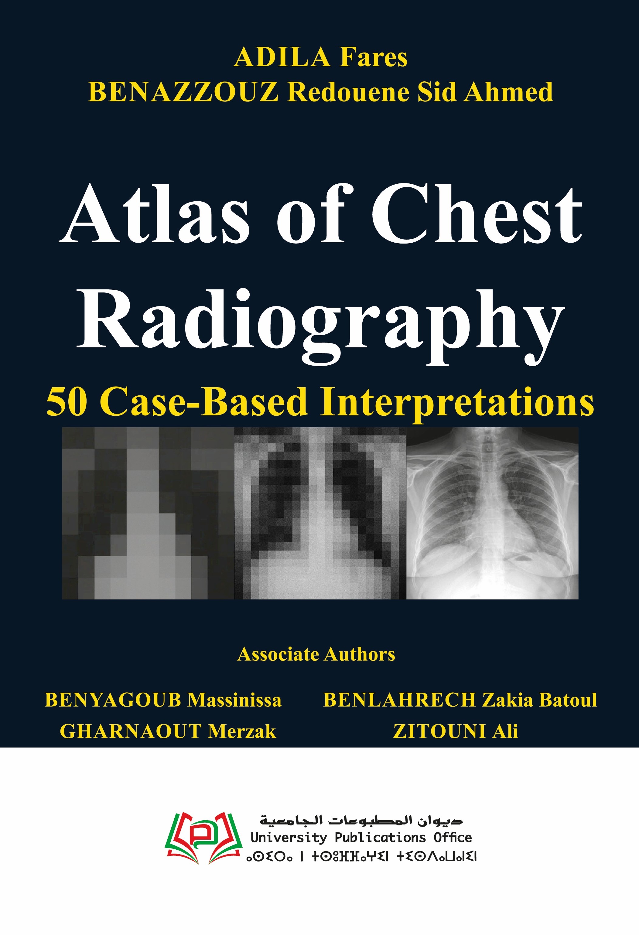 Atlas of Chest Radiography  50 Case-Based Interpretations