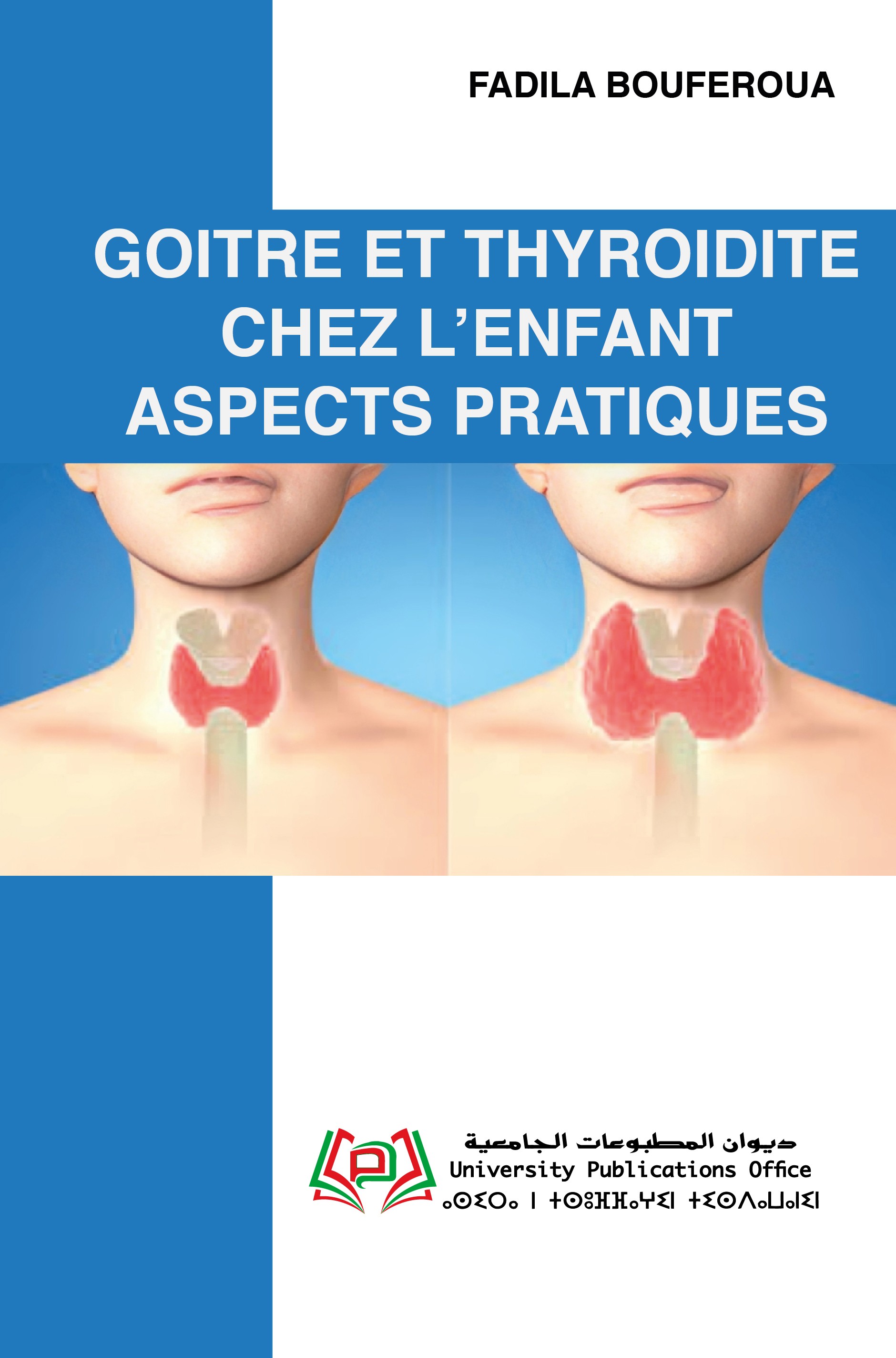 GOITRE ET THYROIDITE CHEZ L’ENFANT ASPECTS PRATIQUES